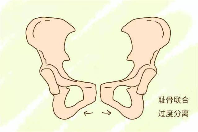 孕4个月耻骨痛，原因、缓解与管理