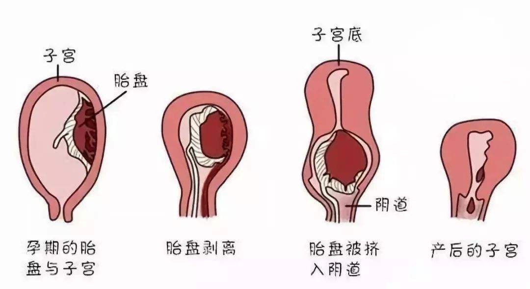 剖腹产半个月了伤口还疼正常吗？解读产后恢复过程中的常见问题